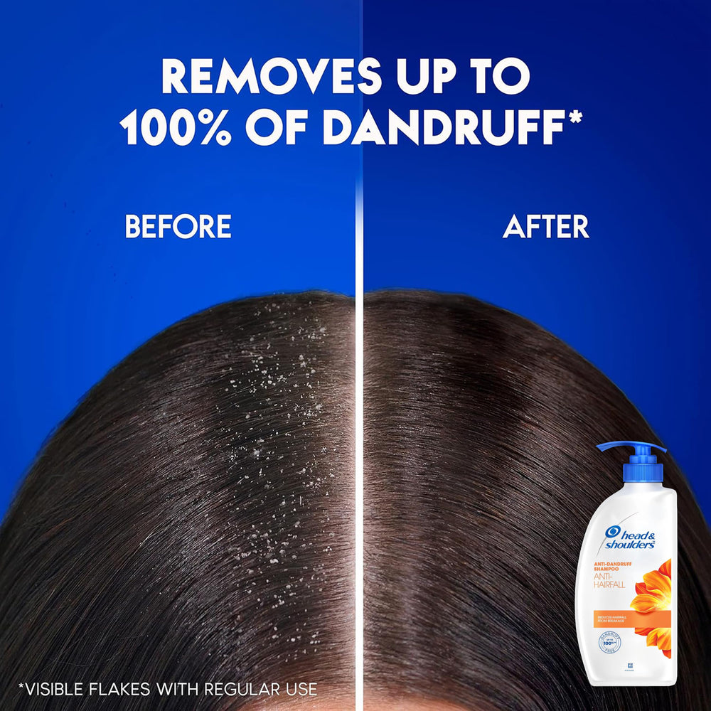 Head & Shoulders bathroom setup scene highlights easy-access storage for scalp care.