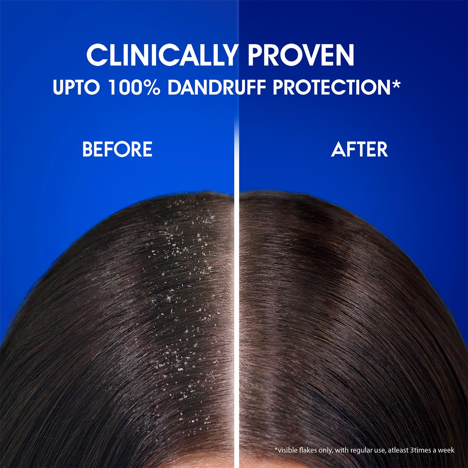 Head & Shoulders Smooth and Silky bottle shown in daily-use setting