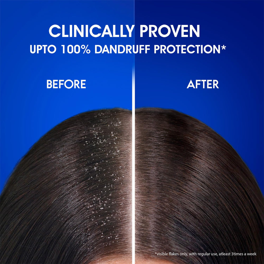 Head & Shoulders Smooth and Silky bottle shown in daily-use setting