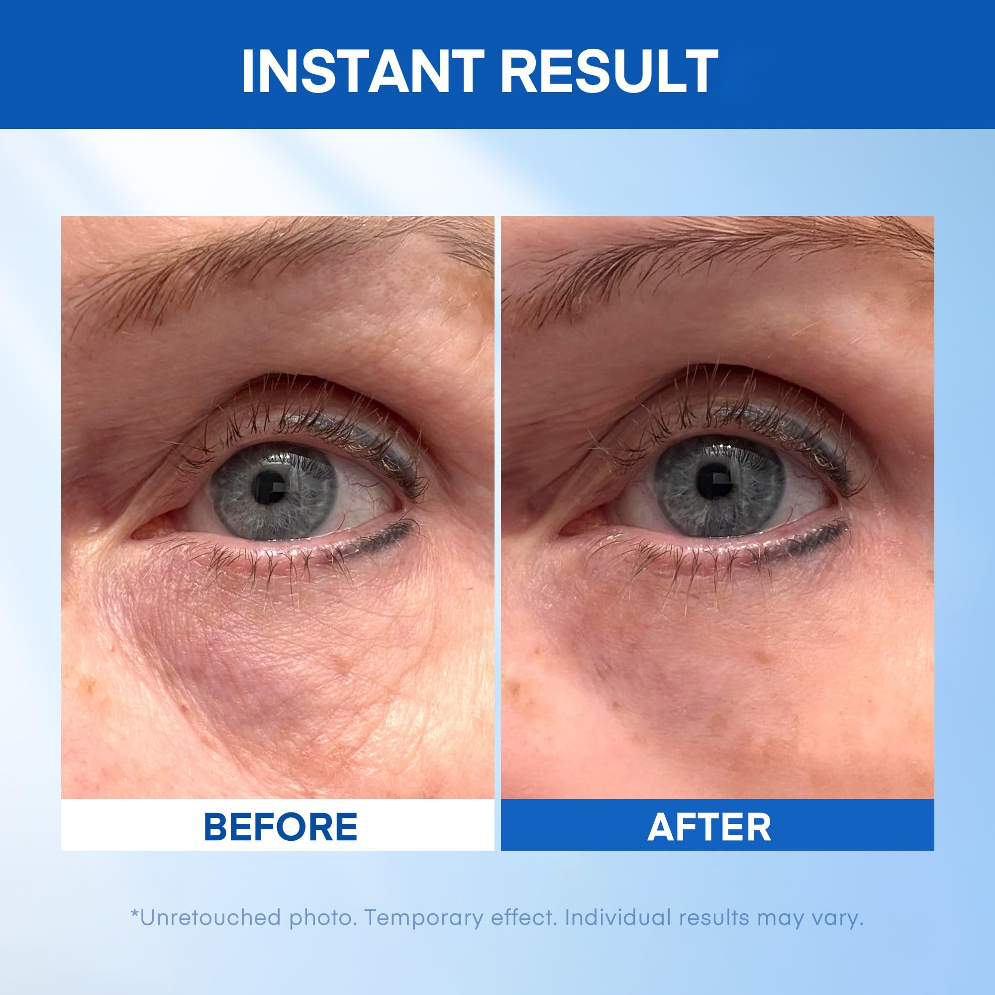 HealthyDerm Instant Under Eye Lift Serum 20 mL tube – non-invasive, needle-free option for mature skin.