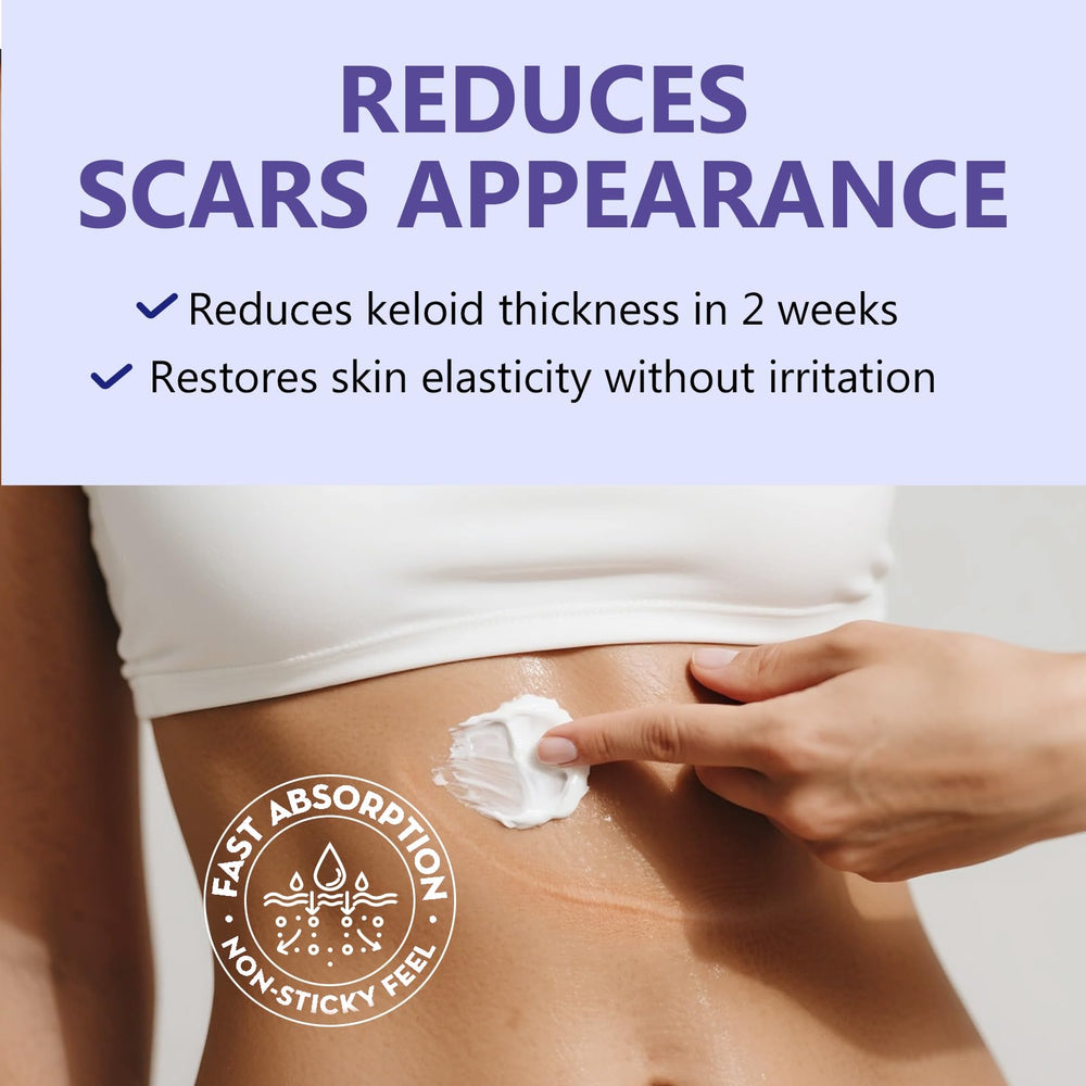 Hemir keloid bump cream applied on skin during daily application.