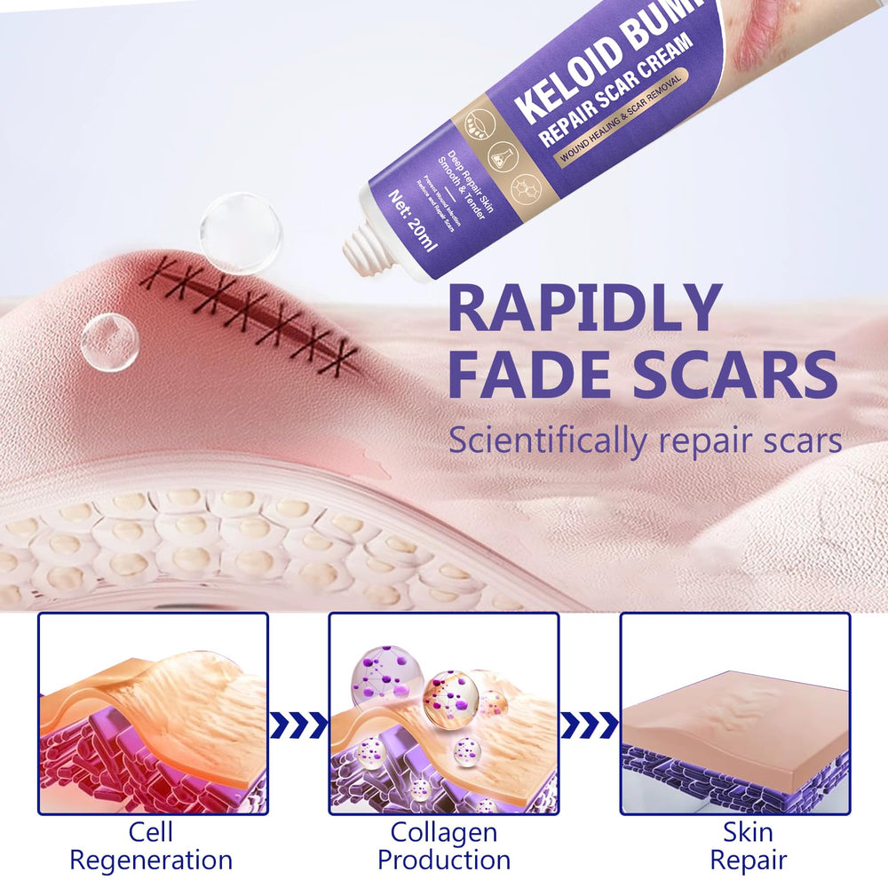 Hemir keloid bump cream on skin illustrating smoothing effect.