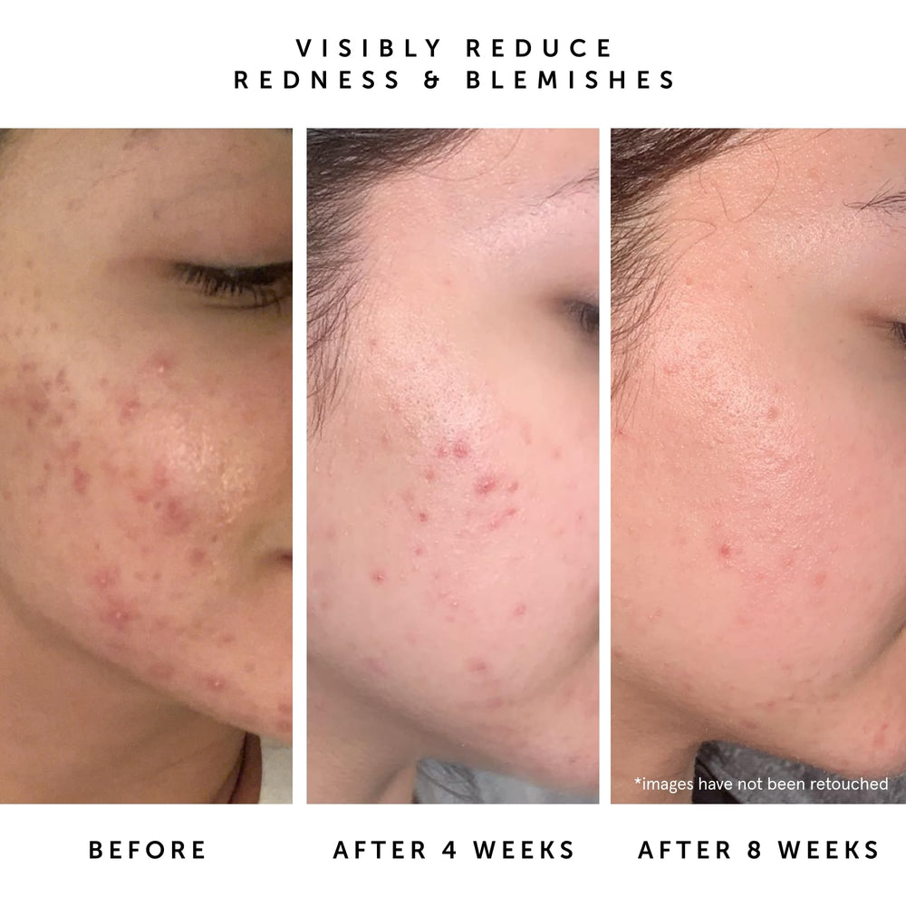 Herbivore Lapis Facial Oil hand-application shows quick absorption
