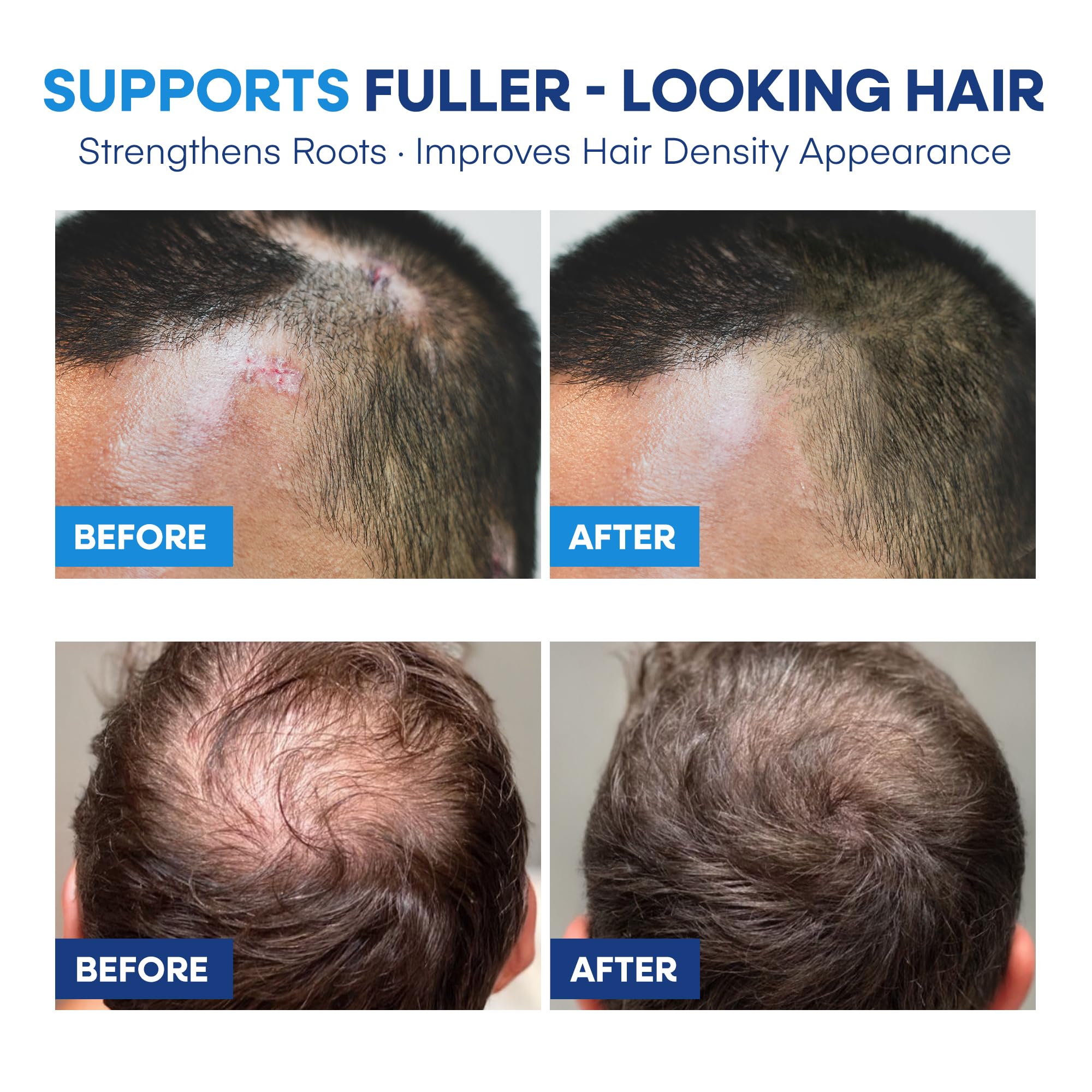 Hermon fermented yeast extract vial implies nourishing scalp barrier.