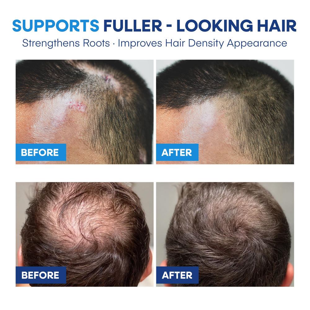 Hermon fermented yeast extract vial implies nourishing scalp barrier.