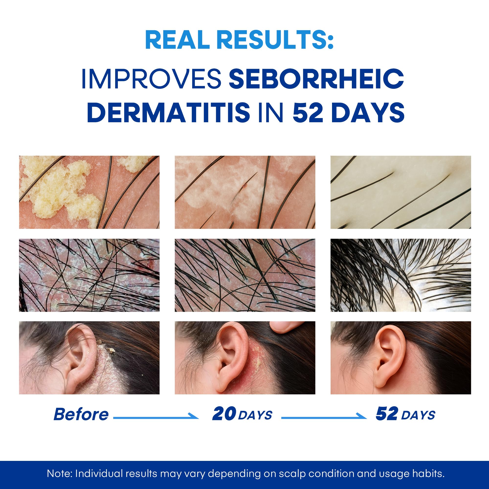 Hermon shampoo lather close-up demonstrates gentle, sulfate-free cleansing.