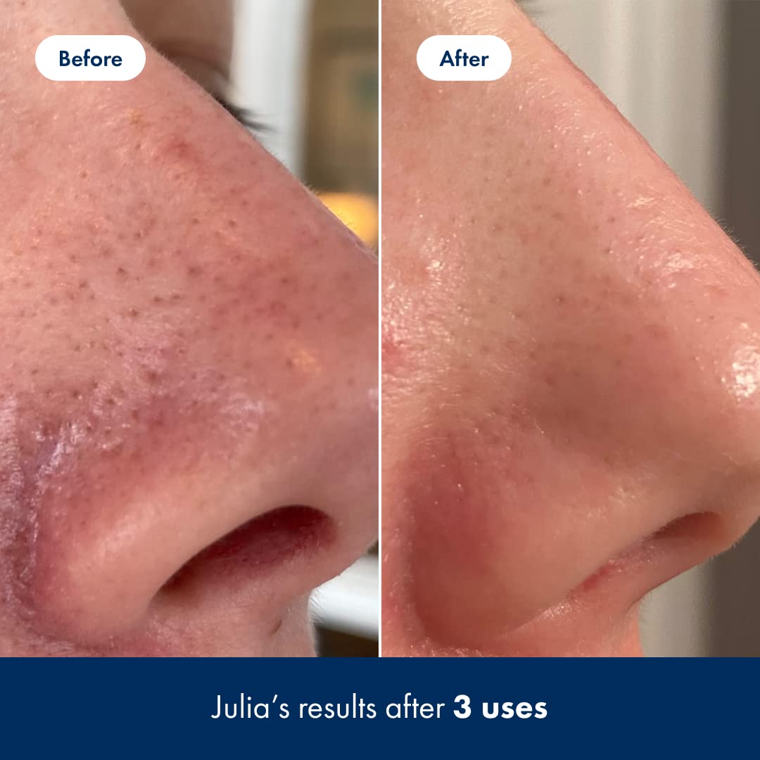 Hero Cosmetics Aloe and Lotus Water soothe while exfoliating for calmer-looking skin.