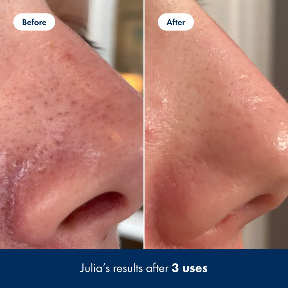 Hero Cosmetics Aloe and Lotus Water soothe while exfoliating for calmer-looking skin.