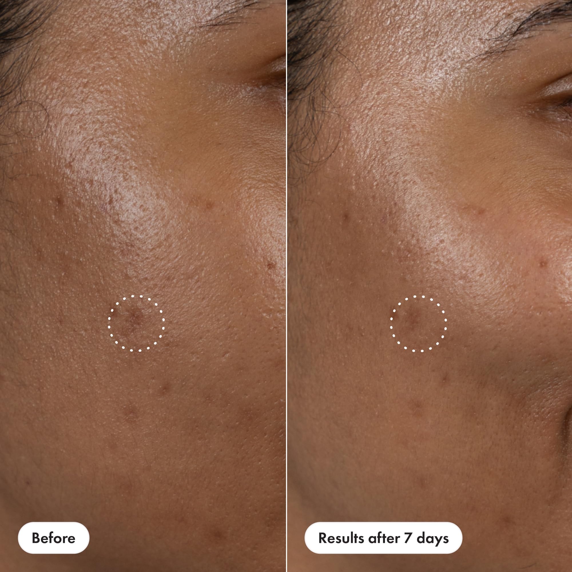 Hero Cosmetics Dark Spot Correct packaging detail emphasizing clean formulation