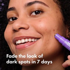 Hero Cosmetics Dark Spot Correct rollerball tip for easy on-the-go application