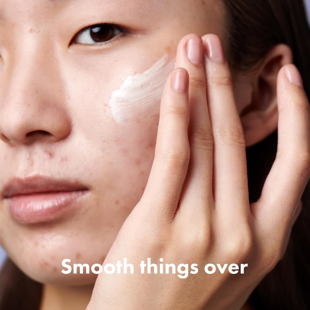 Hero Cosmetics Rescue Retinol Nighttime Cream texture on hand shows non-drying, calming formula.