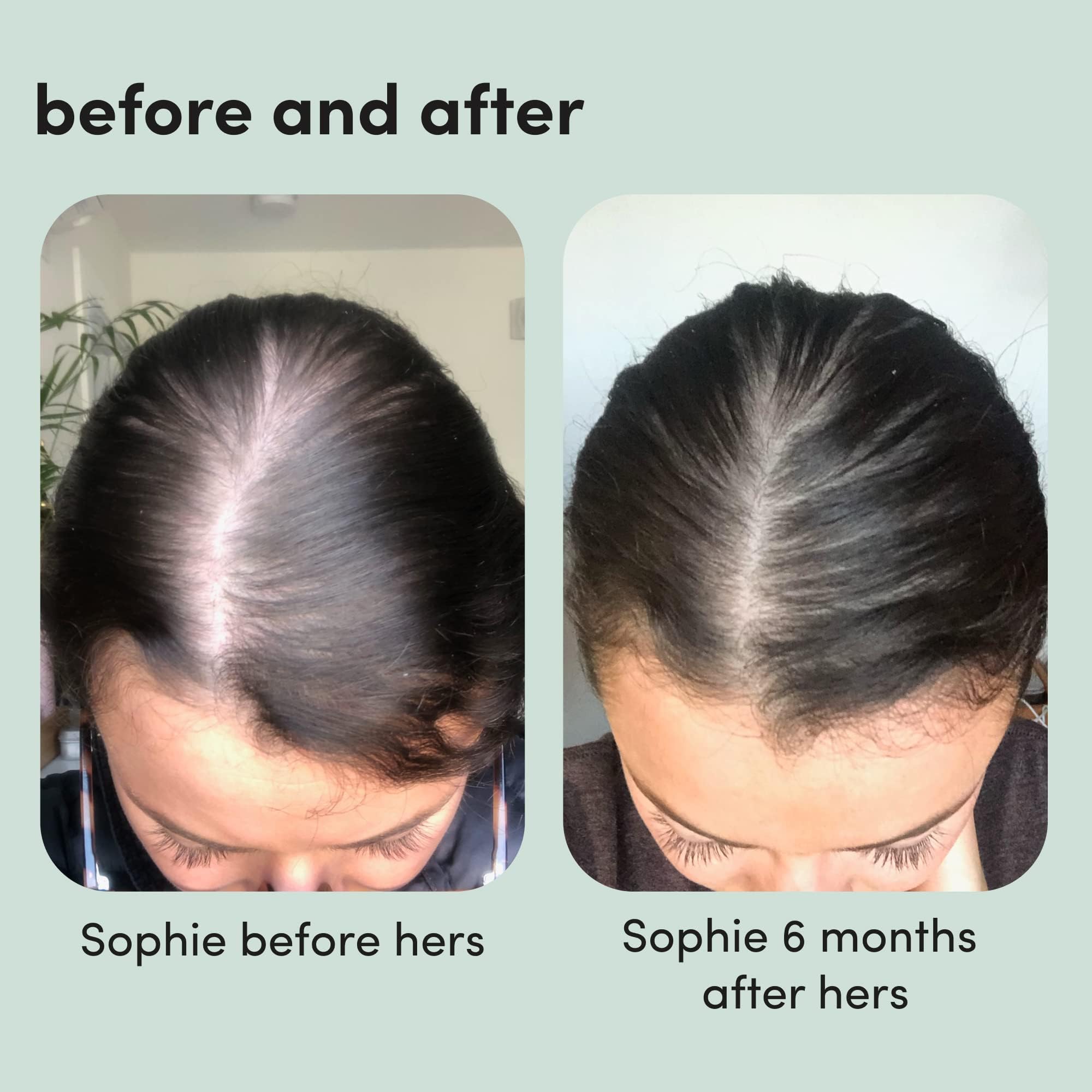 HIMS & HERS regrowth foam in a daily-use scene supports routine.