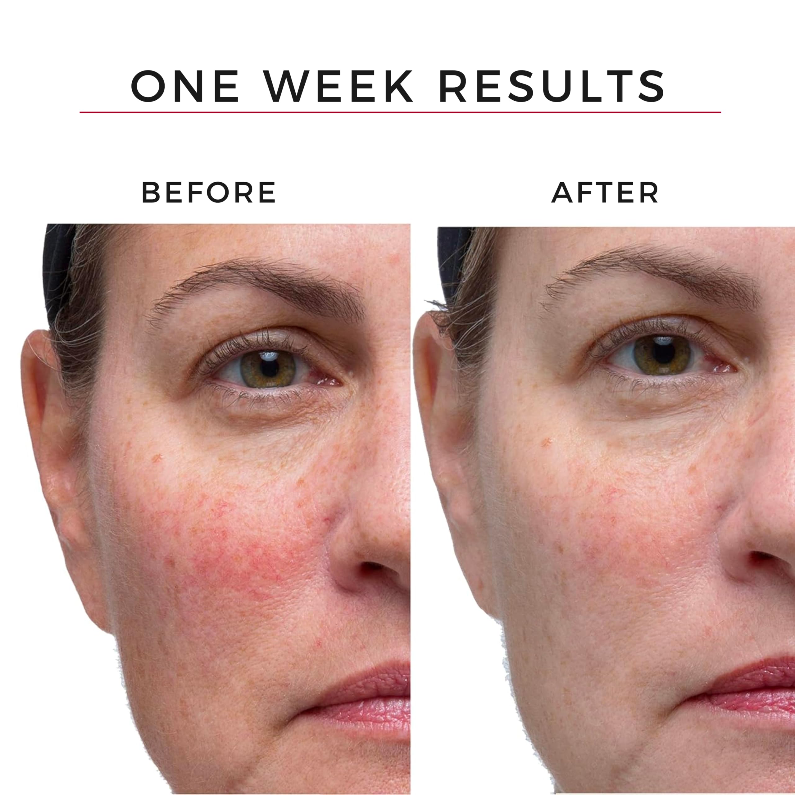 Hey Honey Good Morning Honey ingredients honey-niacinamide boost for balanced skin clarity.