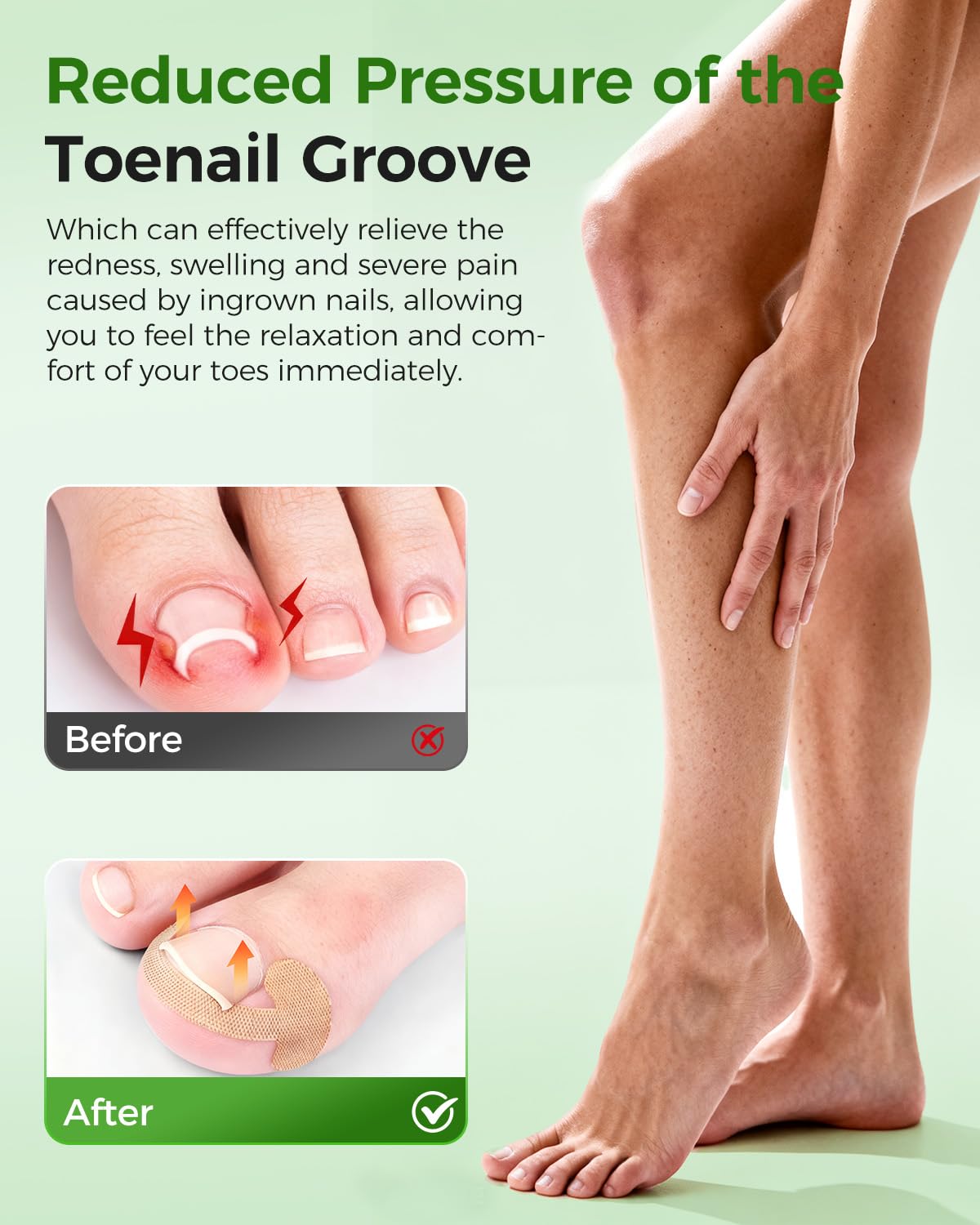 Hoiuter ingrown toenail corrector complete-set provides full care kit for home use
