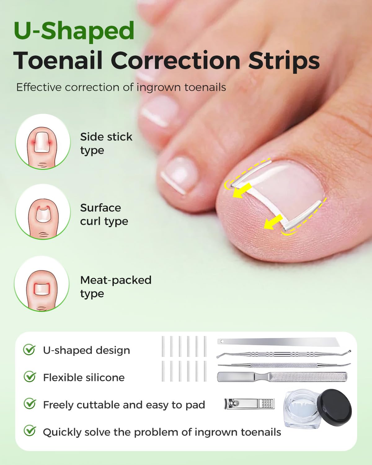 Hoiuter ingrown toenail corrector safe materials emphasize skin-friendly option