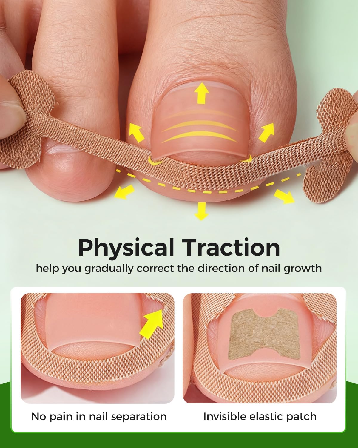 Hoiuter ingrown toenail corrector tools-pack highlights comprehensive home care
