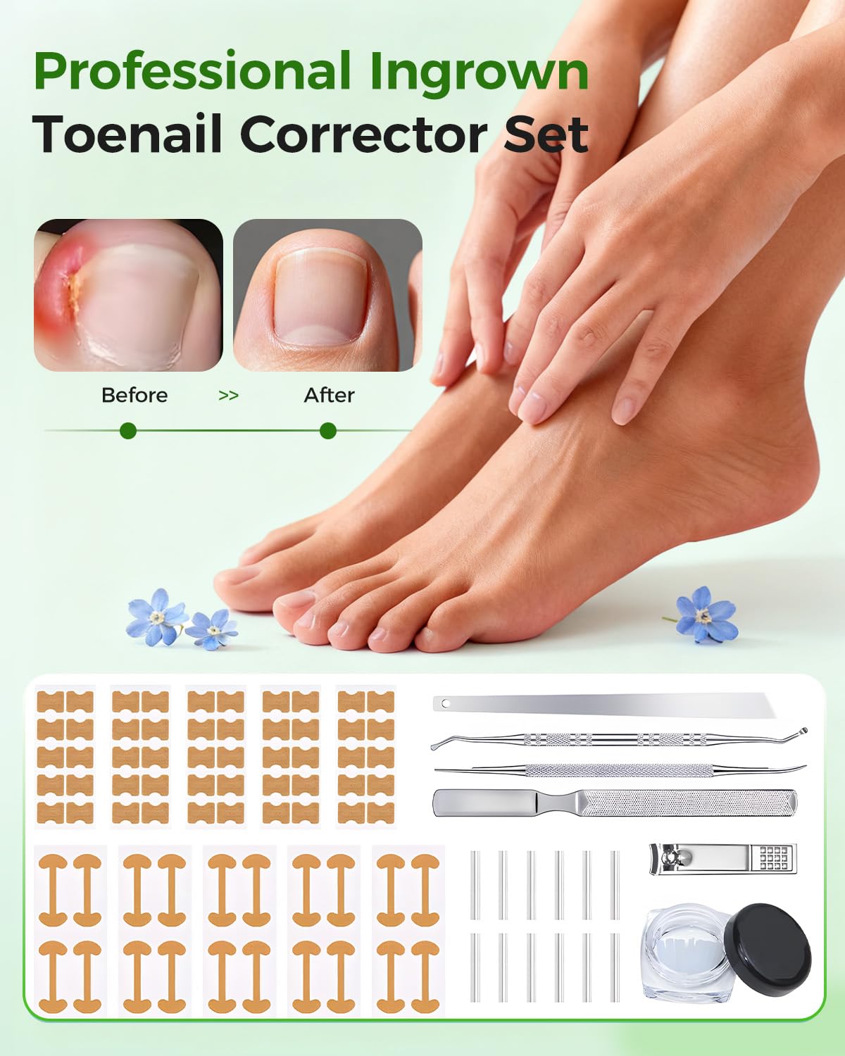 Hoiuter ingrown toenail corrector u-shape design shows secure fit during movement