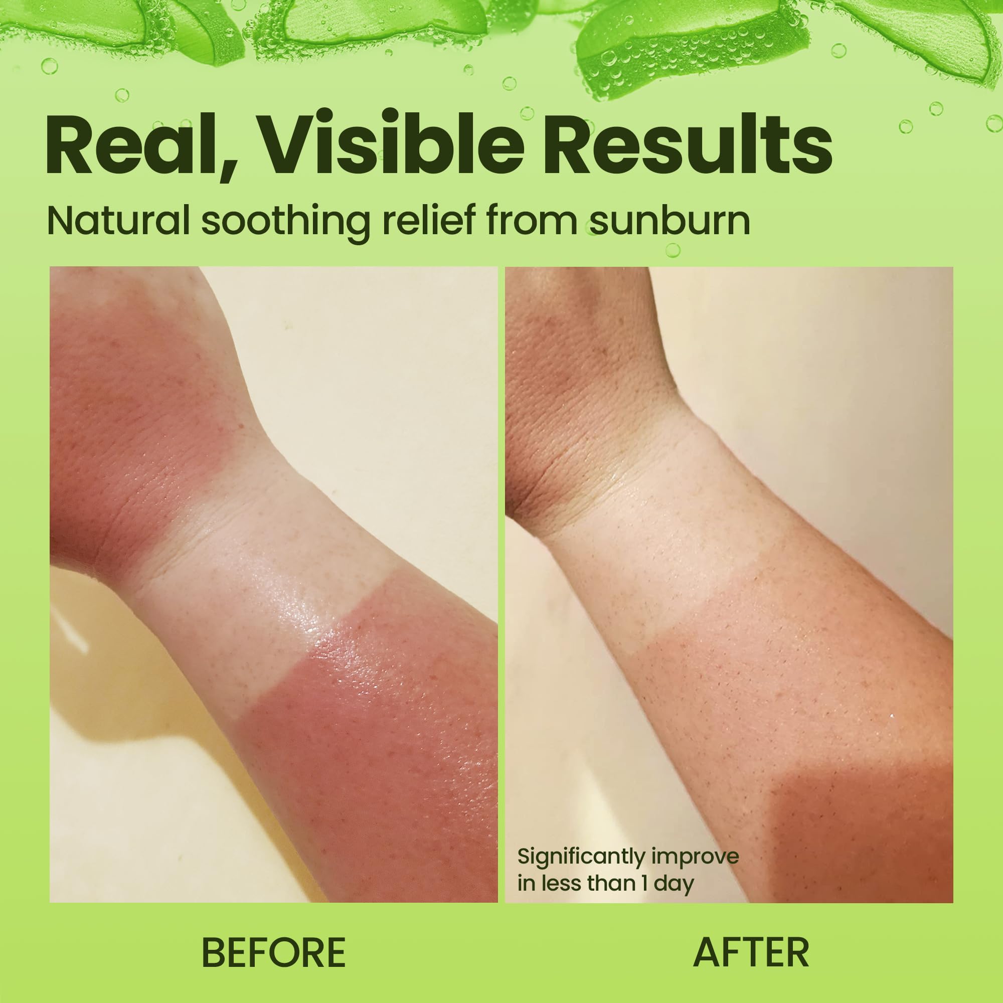 Honeyskin aloe vera gel texture close-up shows smooth non-greasy feel