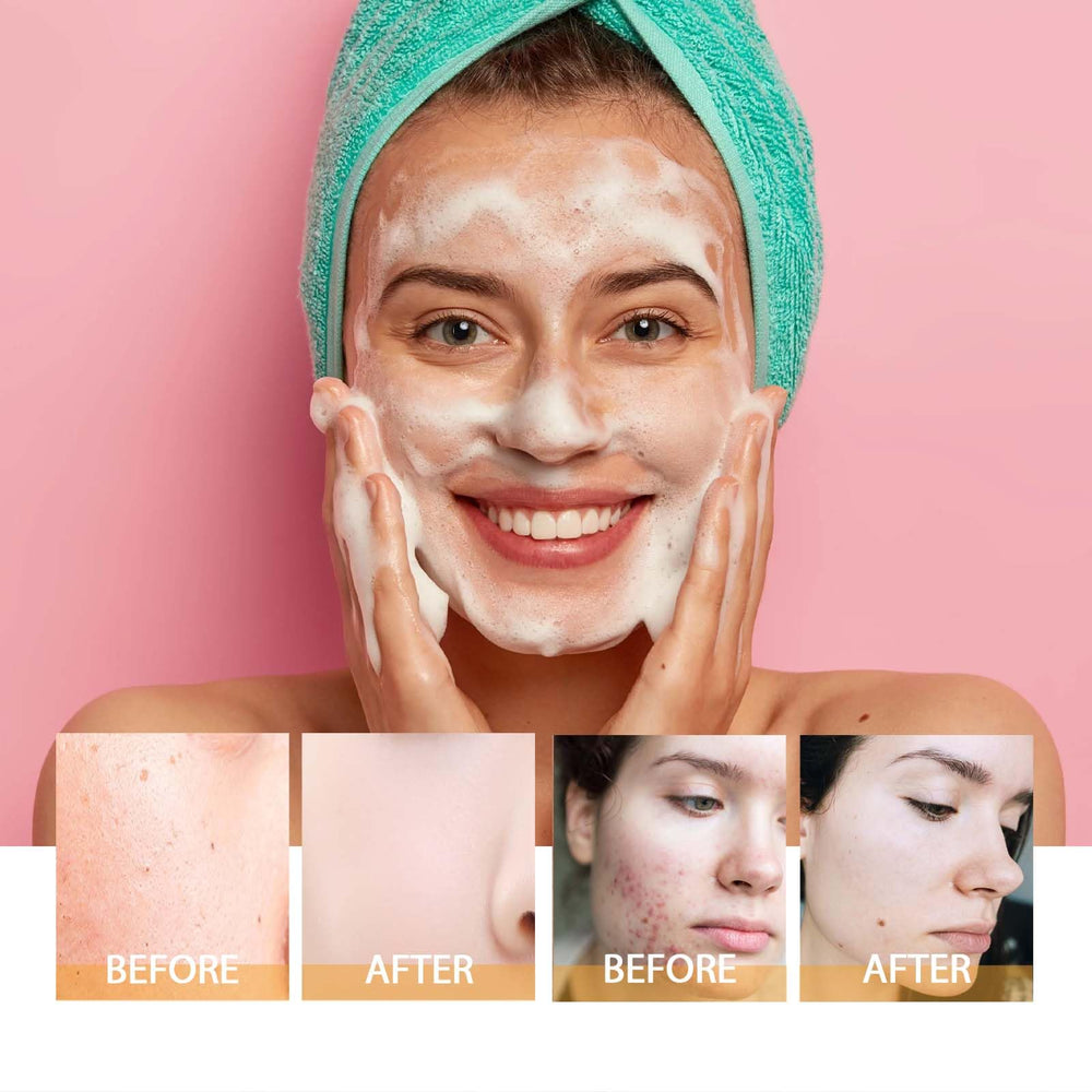 HOYGI Turmeric Face Wash in-use shows circular facial massage