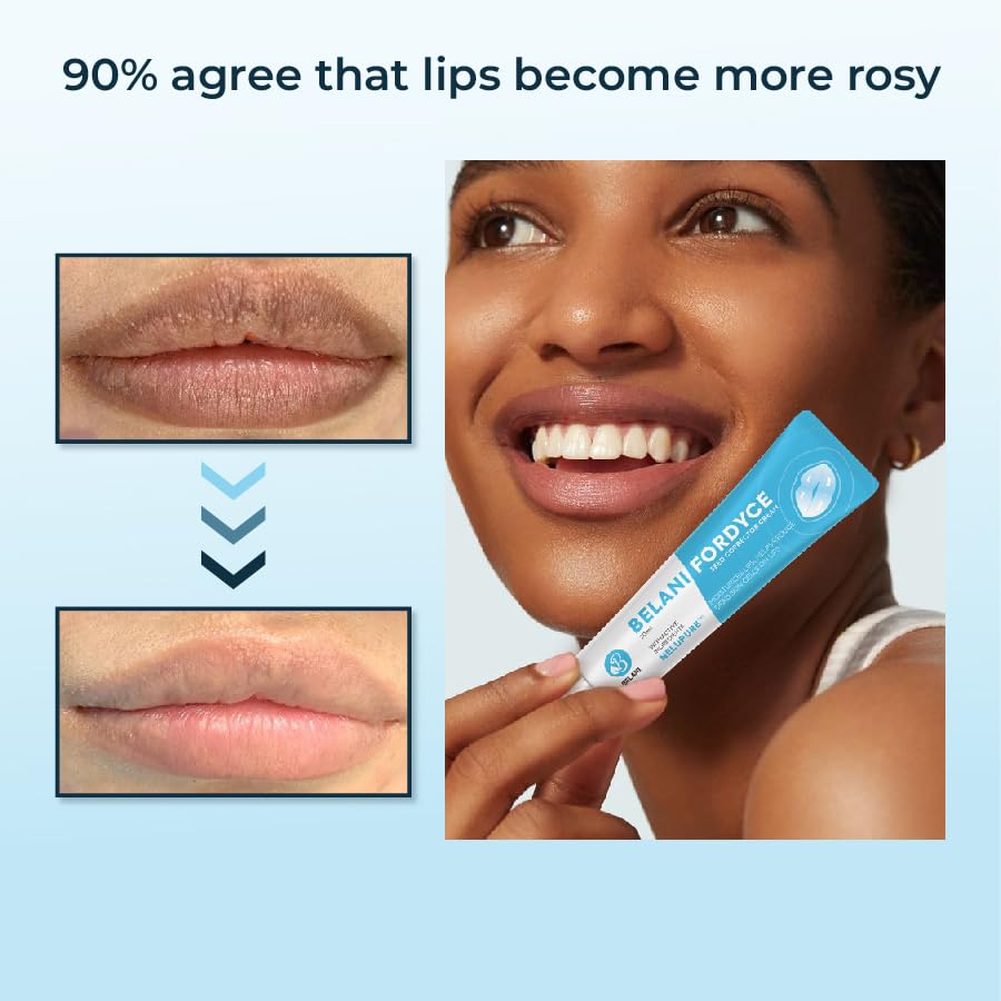 HVSun Belani Fordyce lip cream applied for smooth moisture.