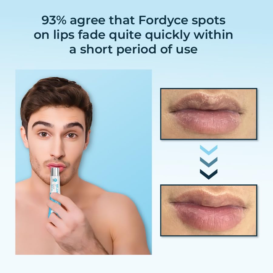 HVSun Belani Fordyce lip cream with pink lotus seeds for hydration.