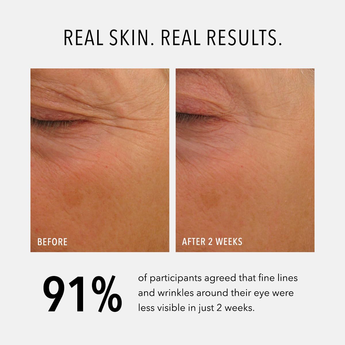 HydroPeptide Eye Authority peptide-boost targets fine lines around the eyes