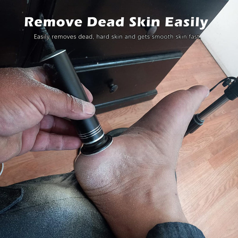 I·B·N G upgraded electric callus remover side grip for comfortable handling.
