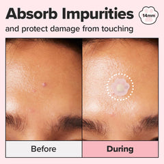 I DEW CARE tea tree oil detail on patch