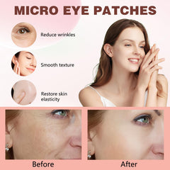 Iiglitch Micro Eye Patches addressing under-eye puffiness with cooling relief