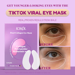 ICIKOL collagen under-eye patches applied on eye shows comfortable fit for morning puffiness care