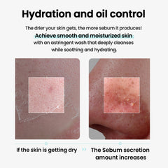 ilso Super Melting Sebum Cleansing Oil blue pore-complex close-up highlights pore-friendly cleansing benefits.