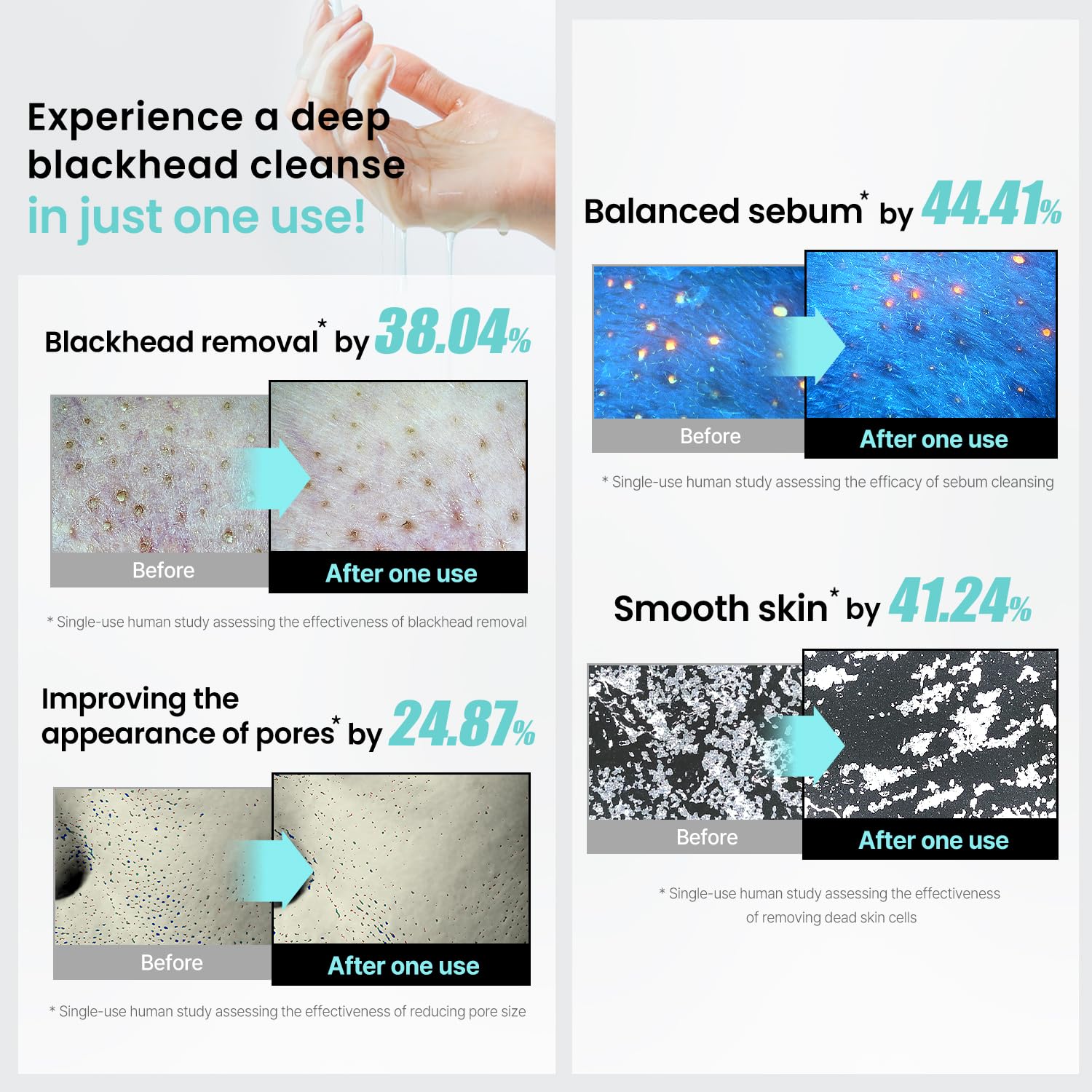 ilso Super Melting Sebum Cleansing Oil Centella extract detail suggests soothing, balanced cleansing.