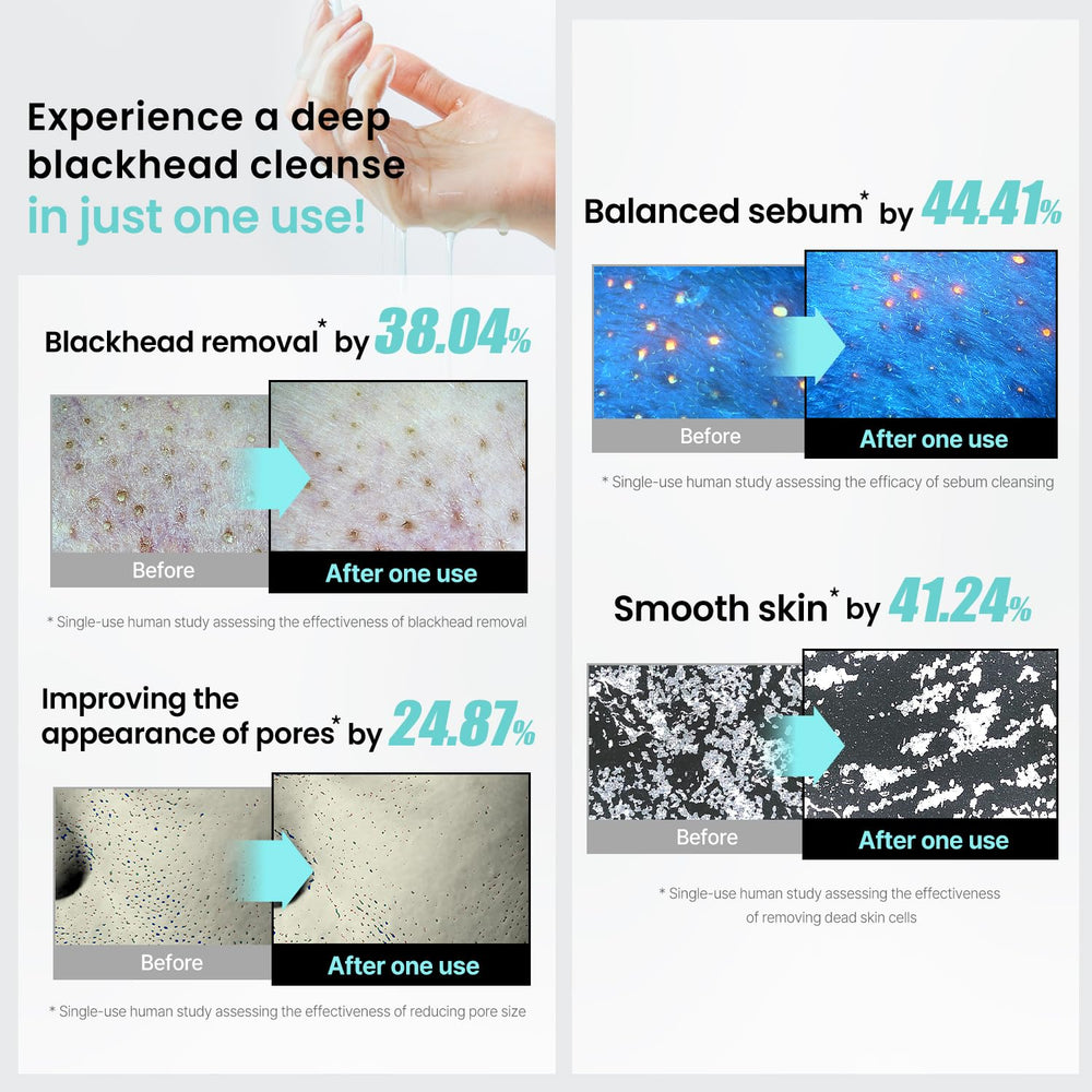 ilso Super Melting Sebum Cleansing Oil Centella extract detail suggests soothing, balanced cleansing.