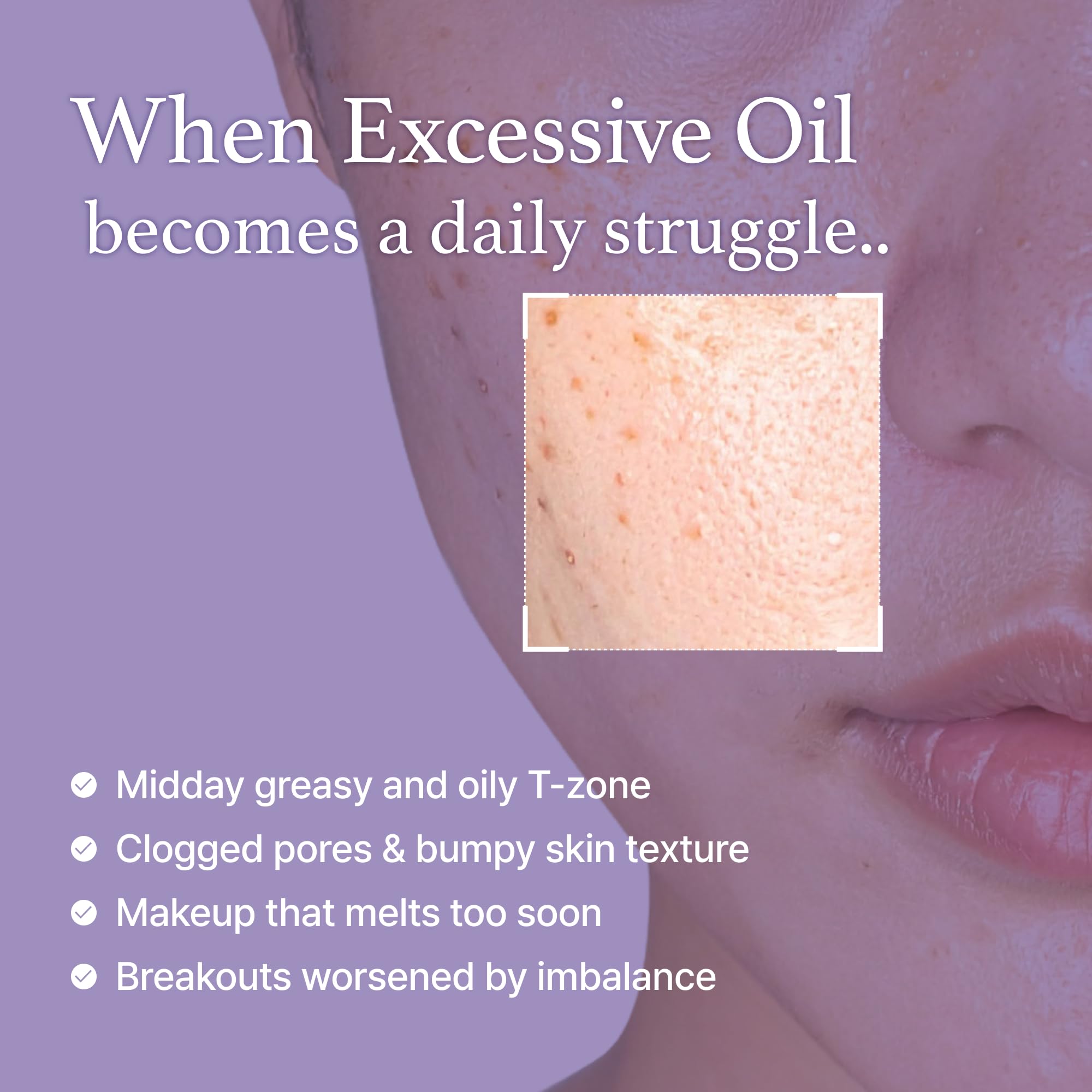 I'm from Black Rice Toner bi-phase formula mid-shake illustrating balanced hydration.