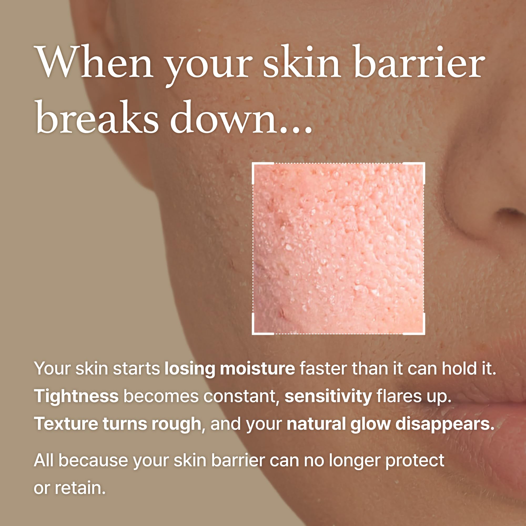 I'm From Rice Cream ceramide layer indicates a stronger skin barrier