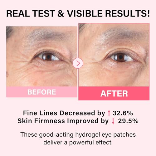 iMethod PDRN eye mask in-use on eyes for instant cooling relief and tightening.