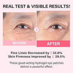 iMethod PDRN eye mask in-use on eyes for instant cooling relief and tightening.