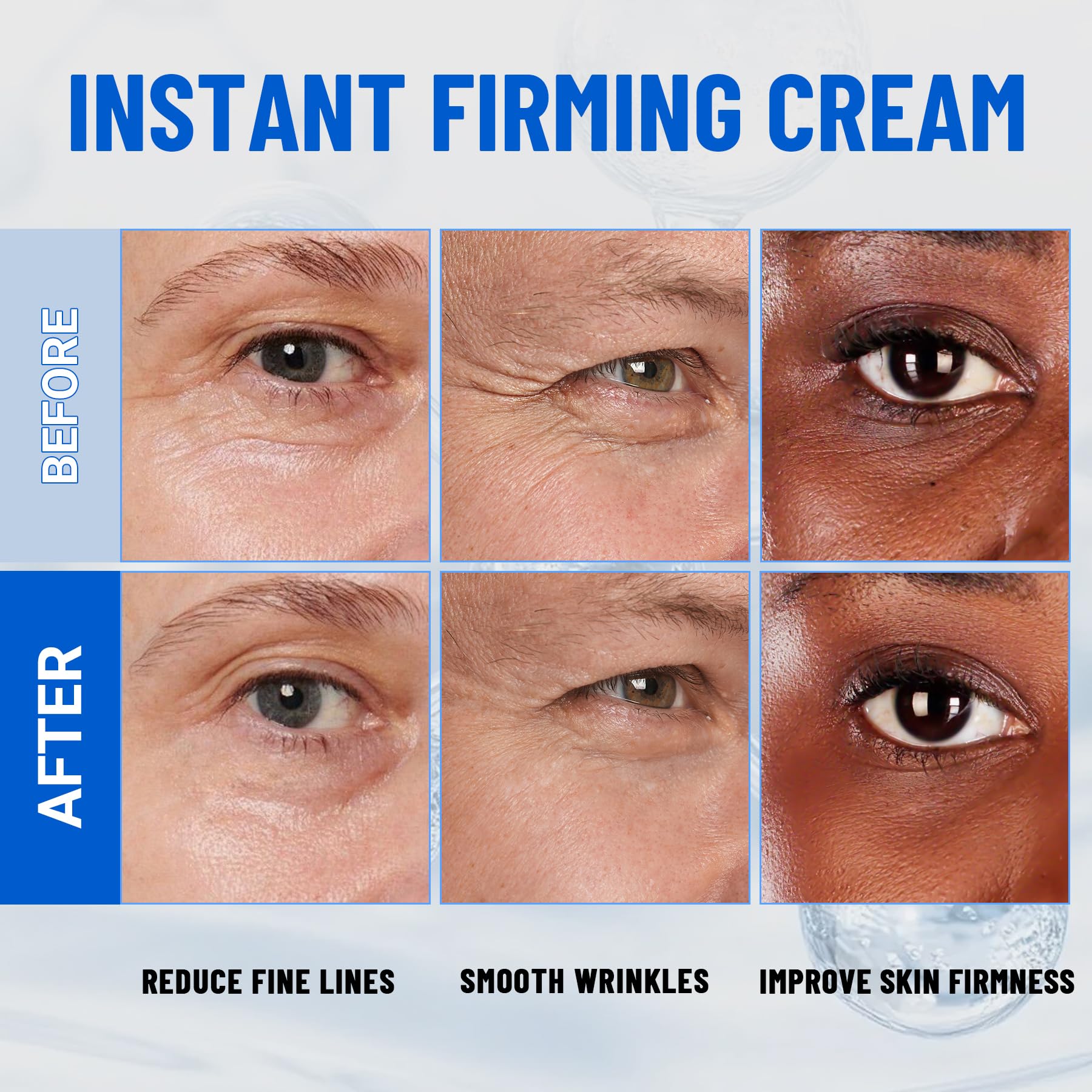 iMethod Perfection Eye Tightener puffiness image communicates refreshed under-eye appearance.