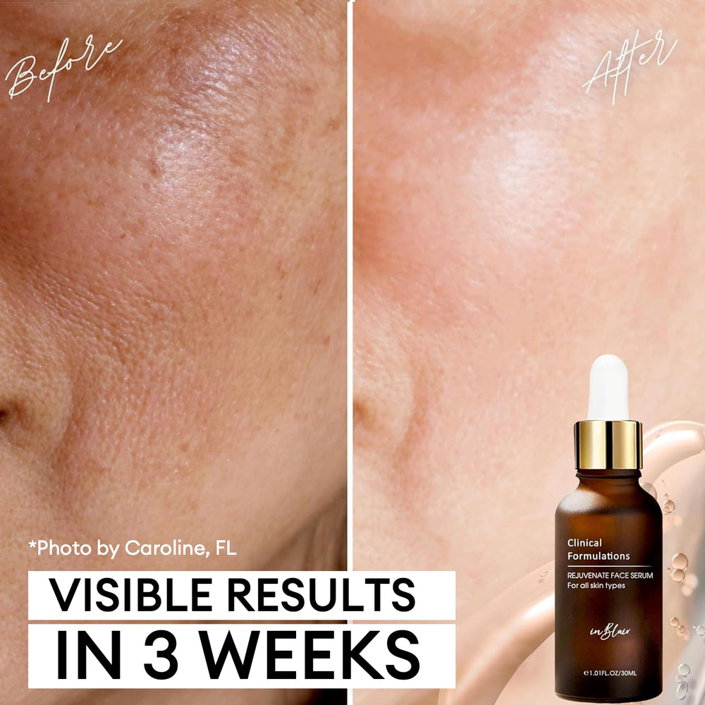 Inblair Rejuvenate Serum label close-up highlights clean ingredients.