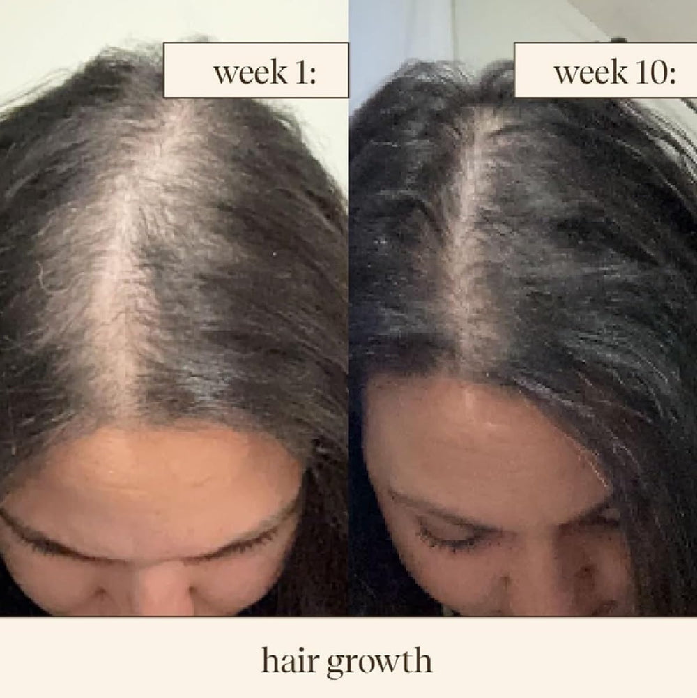 Inde Wild Champi Bhringraj visuals suggest stronger strands with less breakage