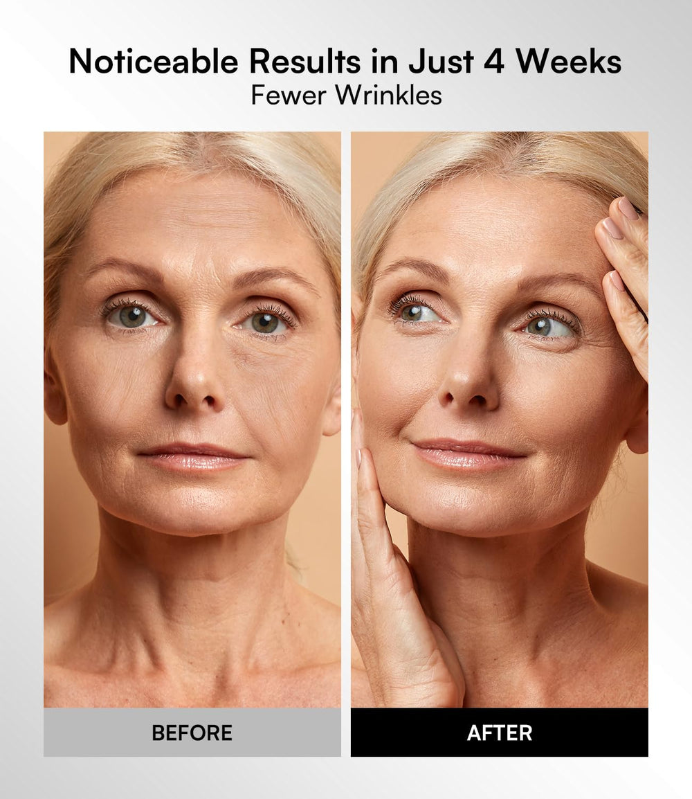 INIA red light mask blue and red modes targeting blemishes and dullness for even tone.