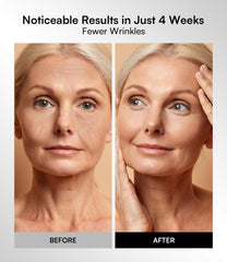 INIA red light mask blue and red modes targeting blemishes and dullness for even tone.
