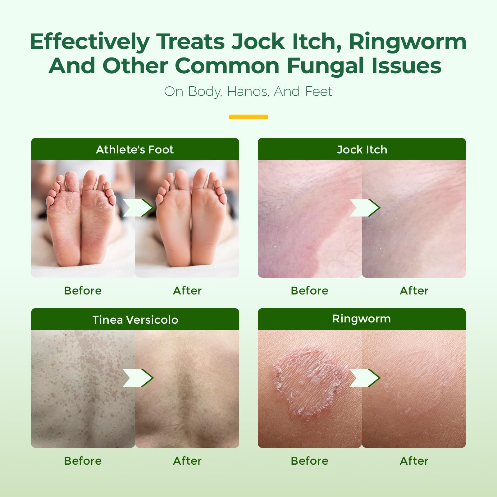 Inlifay antifungal soap after-workout use demonstrates convenient cleansing for active routines.