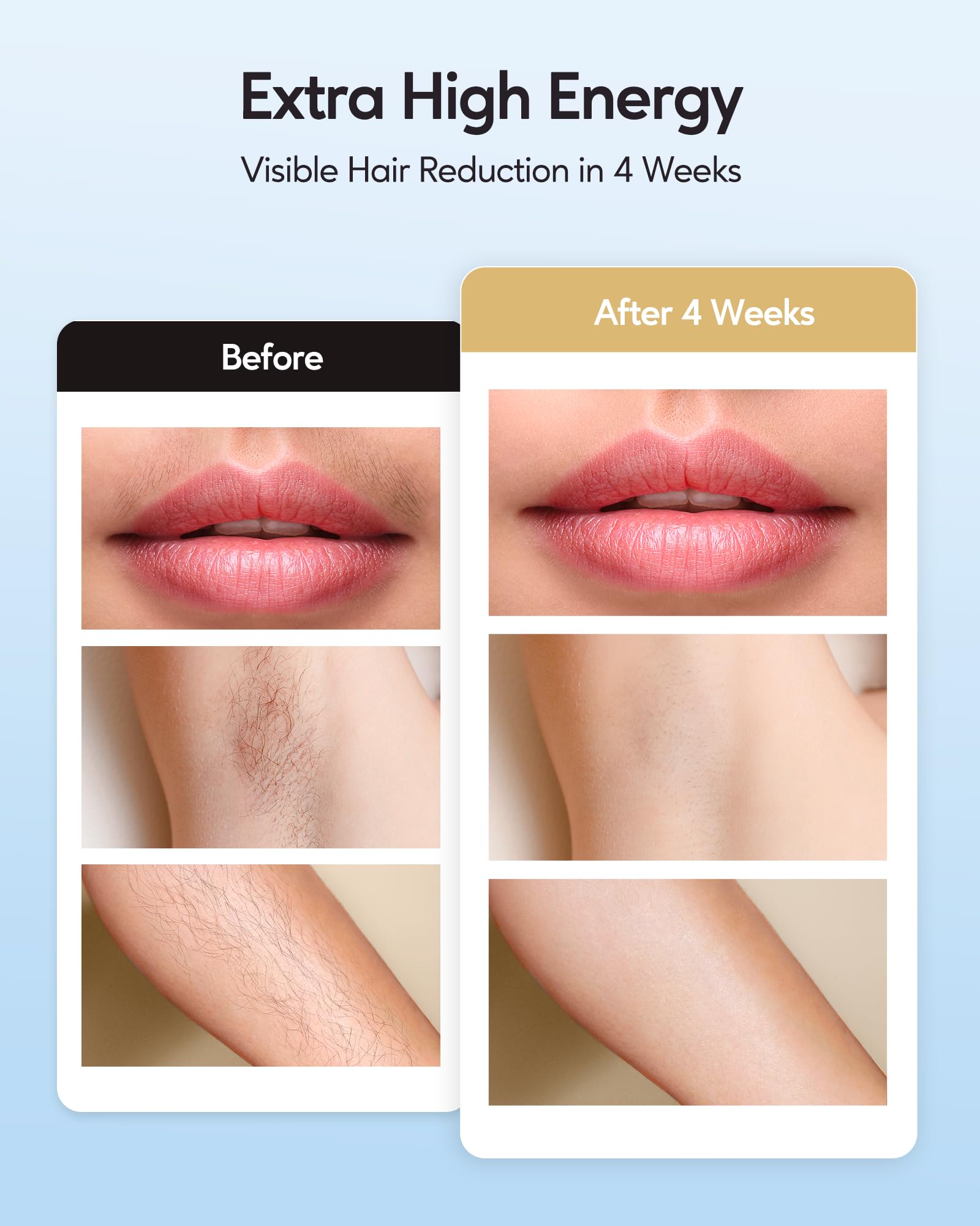 INNZA IPL underarms in manual mode for precision treatment