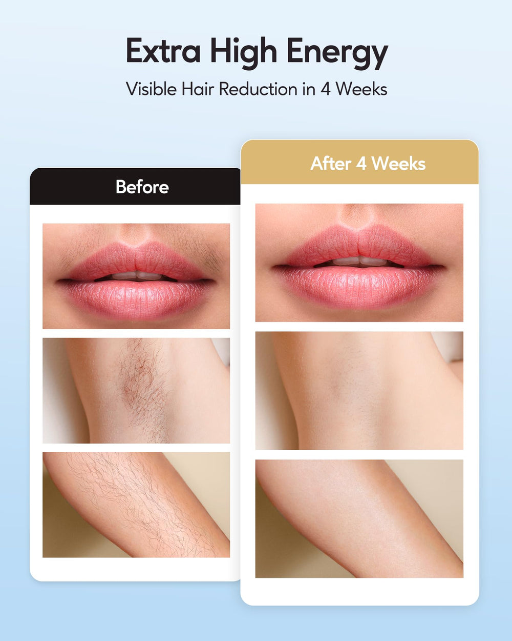 INNZA IPL underarms in manual mode for precision treatment