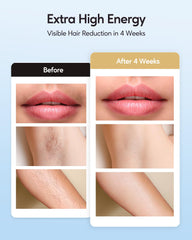 INNZA IPL underarms in manual mode for precision treatment