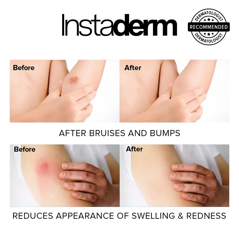 Instaderm Vitamin K Cream may reduce appearance of fine lines and signs of aging.