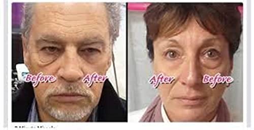 Instantly Ageless dark-circles-target brightens under-eye area.