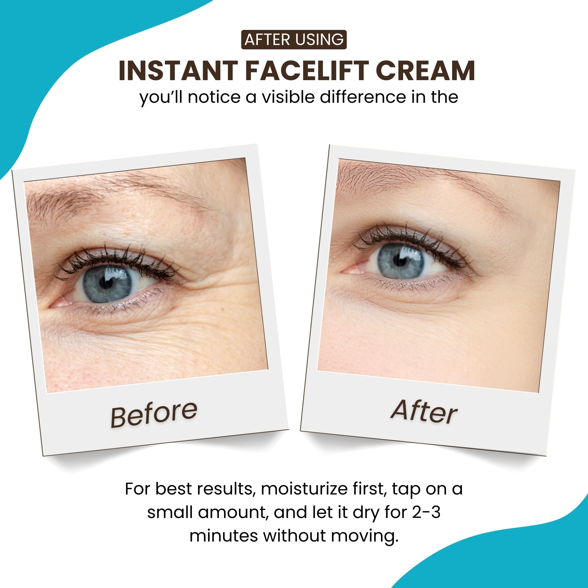 Instantly Ageless neck wrinkles treatment close-up for firming impression