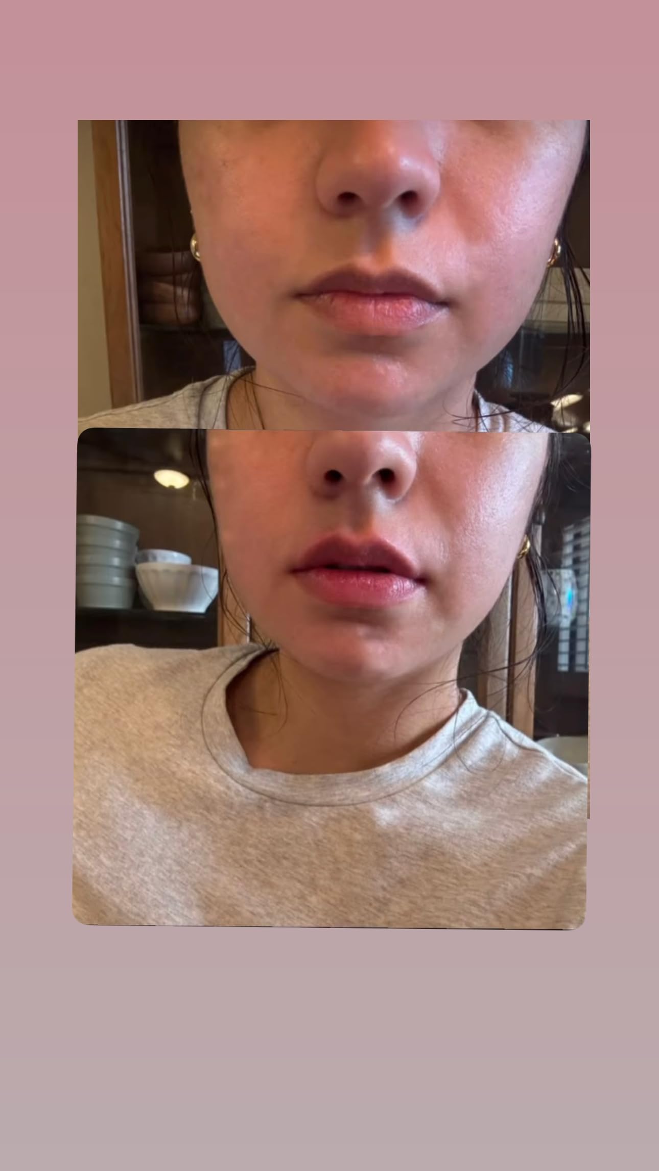Intense Lip Plumping Lipgloss with hyaluronic acid for hydration and smoothness